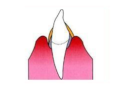img_dental02-01