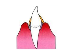 img_dental02-02