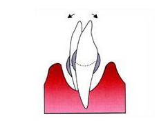 img_dental02-02