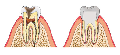 img_dental01-01