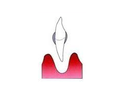 img_dental02-02