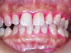 img_dental03-01