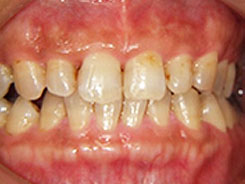 img_dental03-02