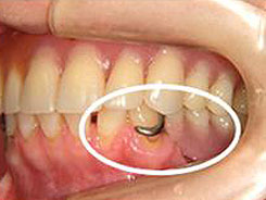 img_dental04-01