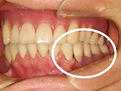 img_dental04-01